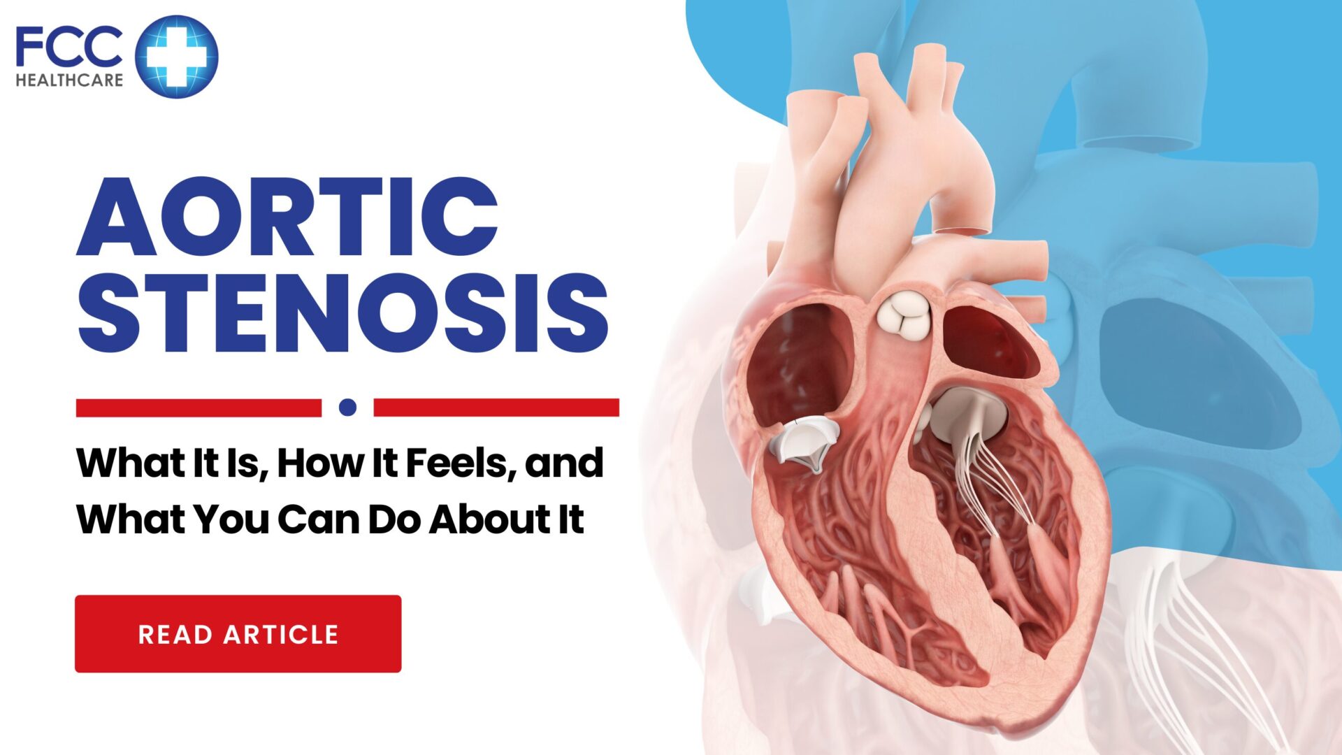 Aortic Stenosis: What It Is, How It Feels, and What You Can Do About It featured image