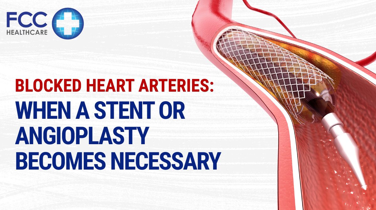 Blocked Heart Arteries: When a Stent or Angioplasty Becomes Necessary featured image