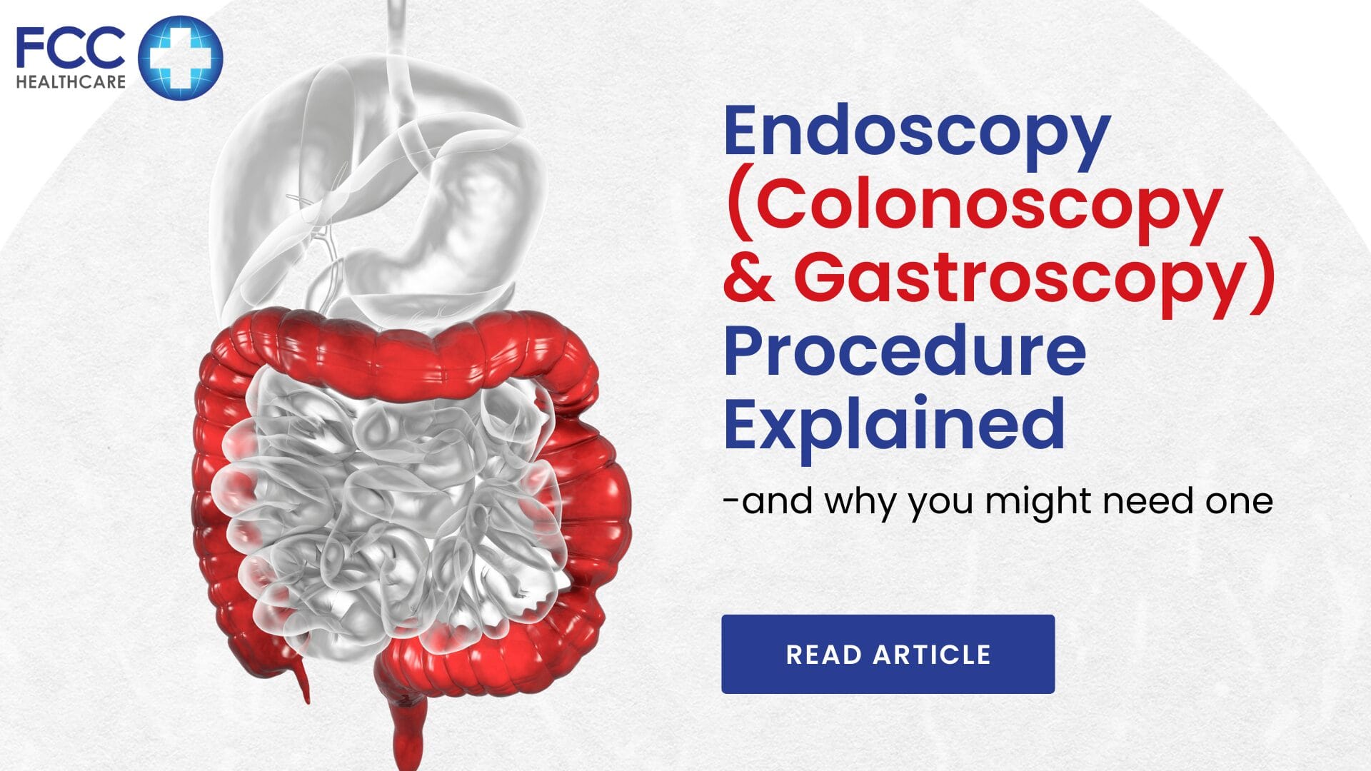 Endoscopy Procedure Explained — and why you might need one featured image