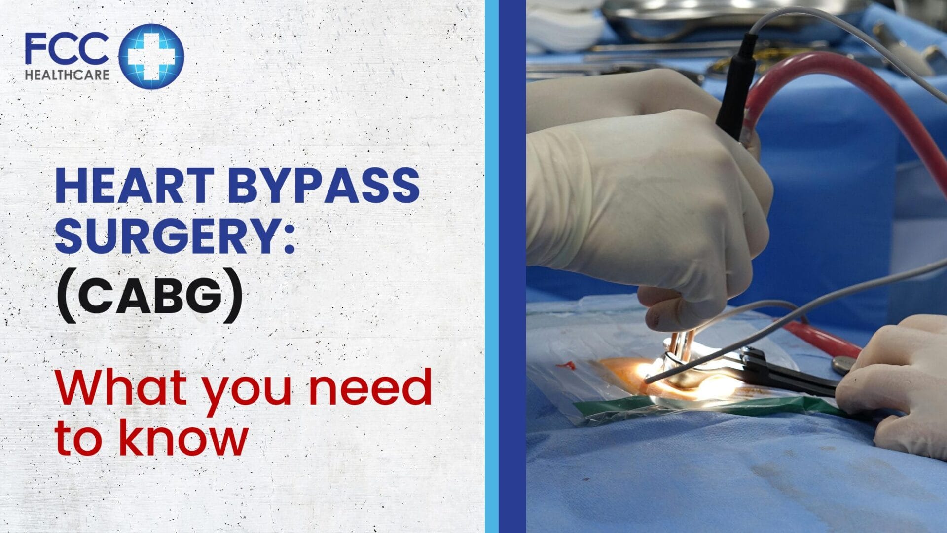 Heart Bypass Surgery: What you need to know featured image