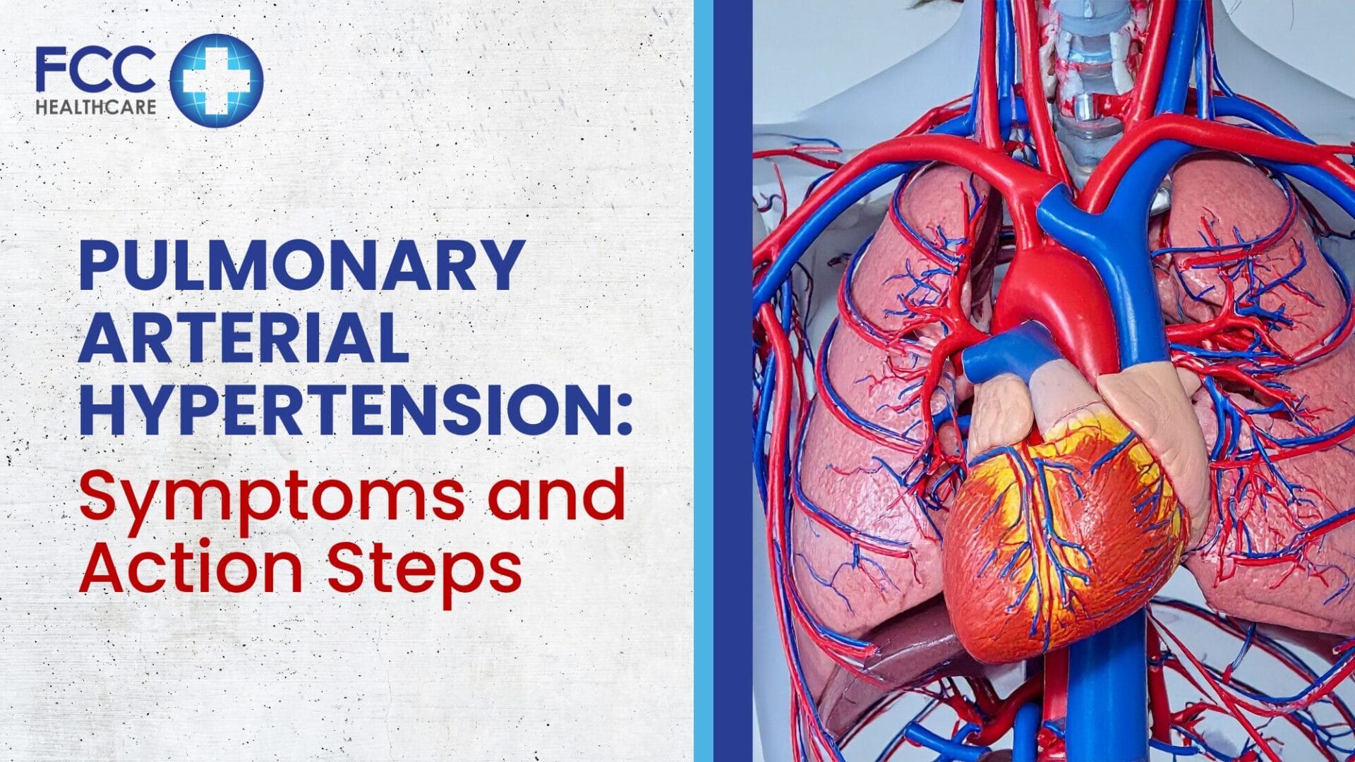 Pulmonary Arterial Hypertension: Symptoms and Action Steps featured image