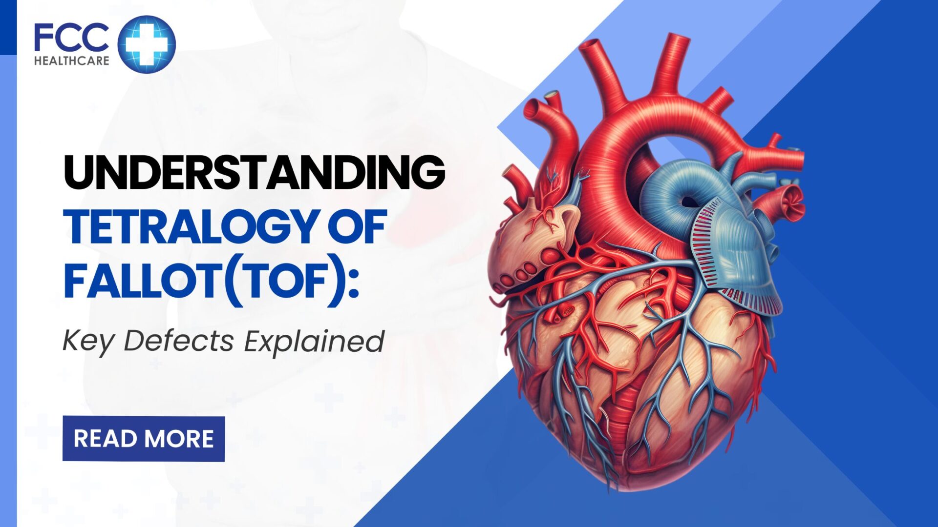 Understanding Tetralogy of Fallot: Key Defects Explained featured image