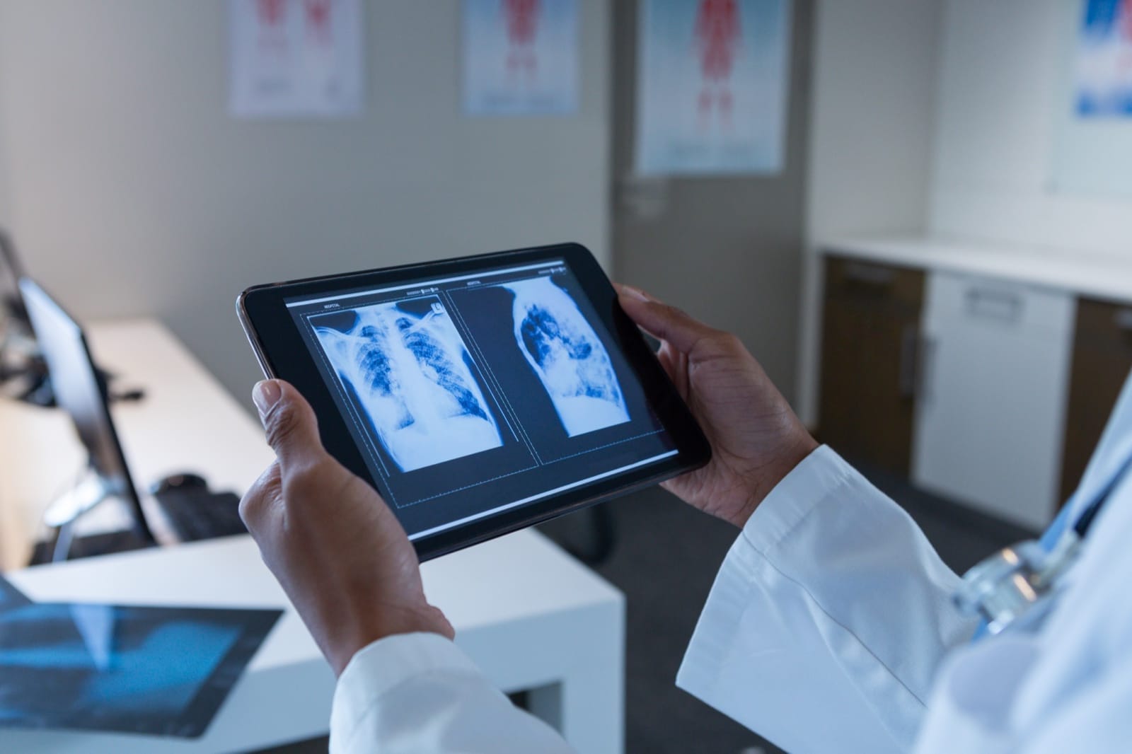 Interventional Radiology