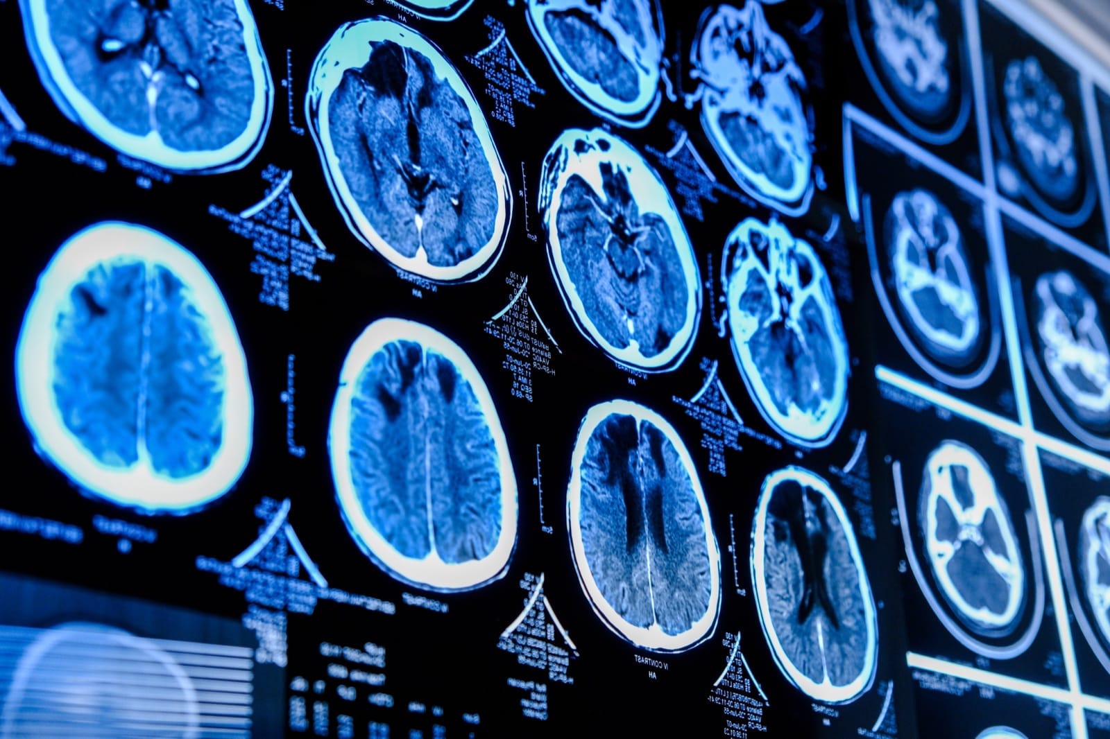 Neurosurgery & Neurology